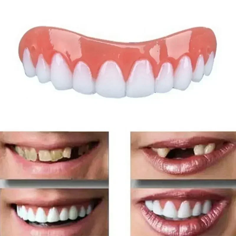Teeth Whitening Veneers - Yeni Takma Dişler Silikon Üst ve