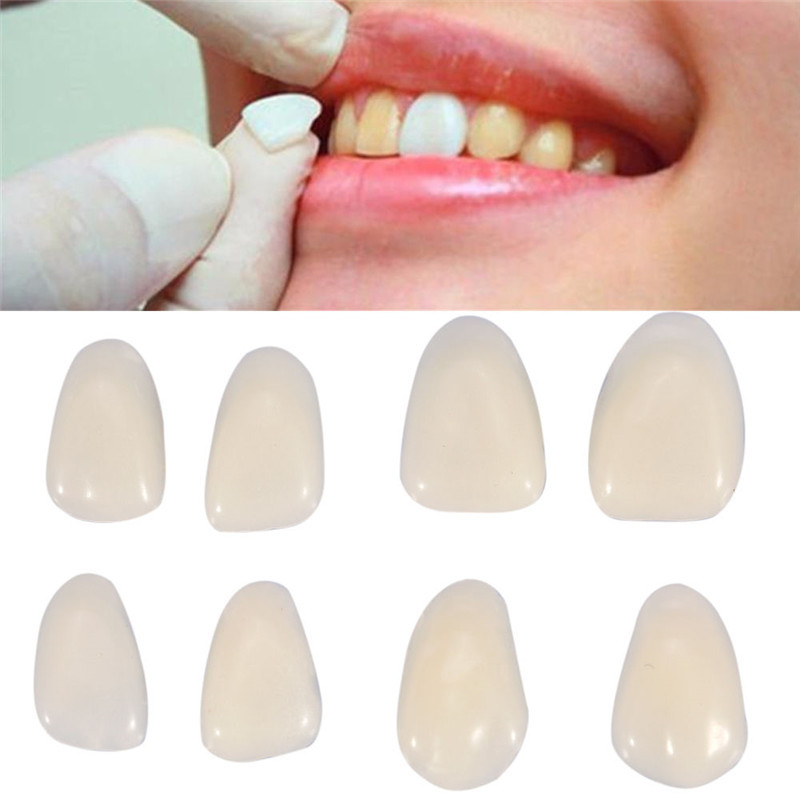 Teeth Whitening Veneers - Diş Yanlış Diş Geçici Taç Diş