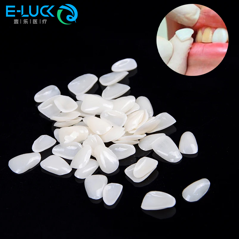 Teeth Whitening Veneers - 50 adet Diş Diş Kaplamaları Geçici