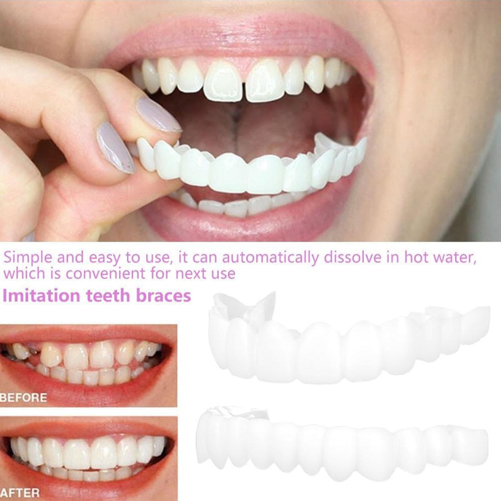Teeth Whitening Veneers - 2 adet Erkek Kadın Geçici Diş