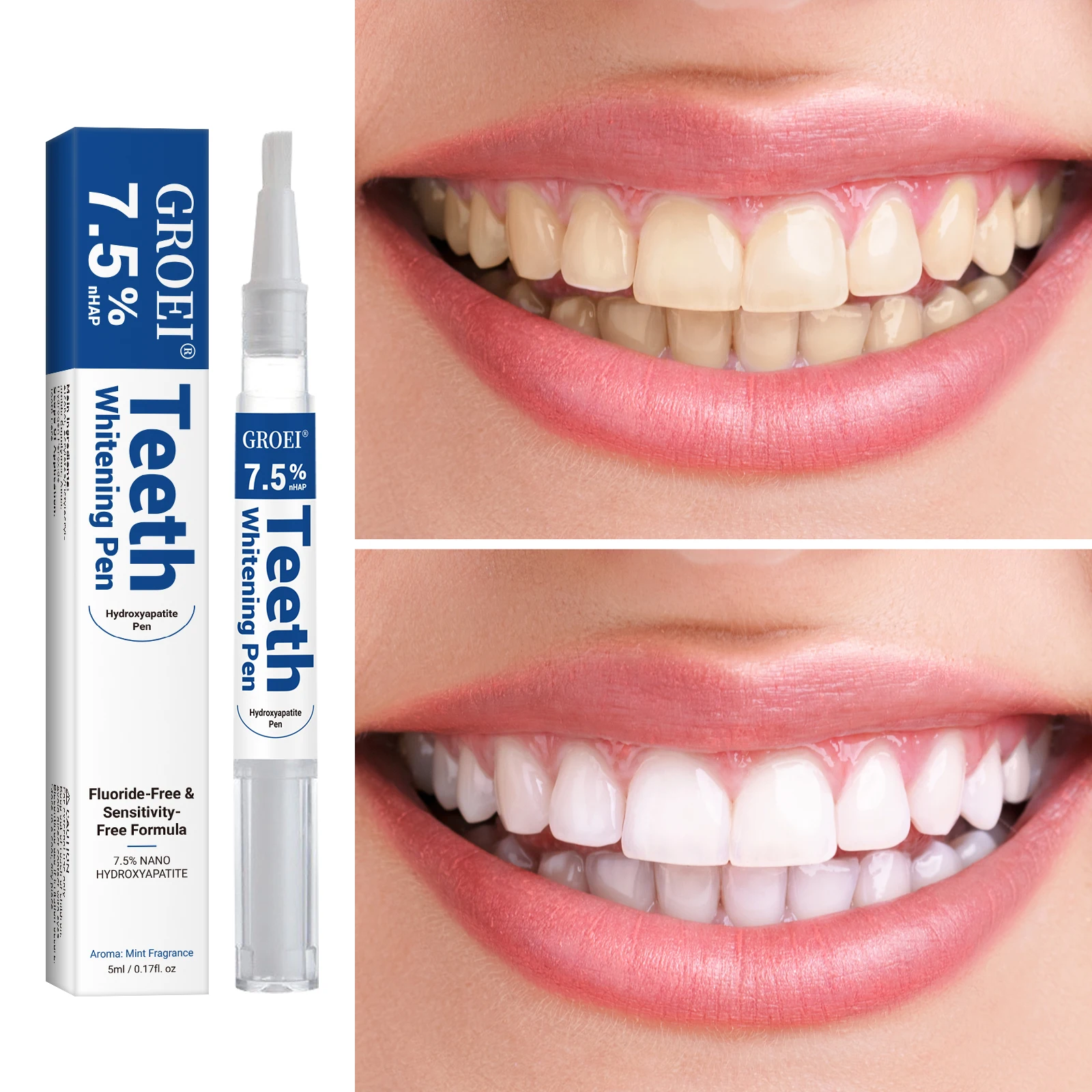 Hidroksiapatit Diş Beyazlatma  - Teeth Whitening Price incelemesi ve fiyatı