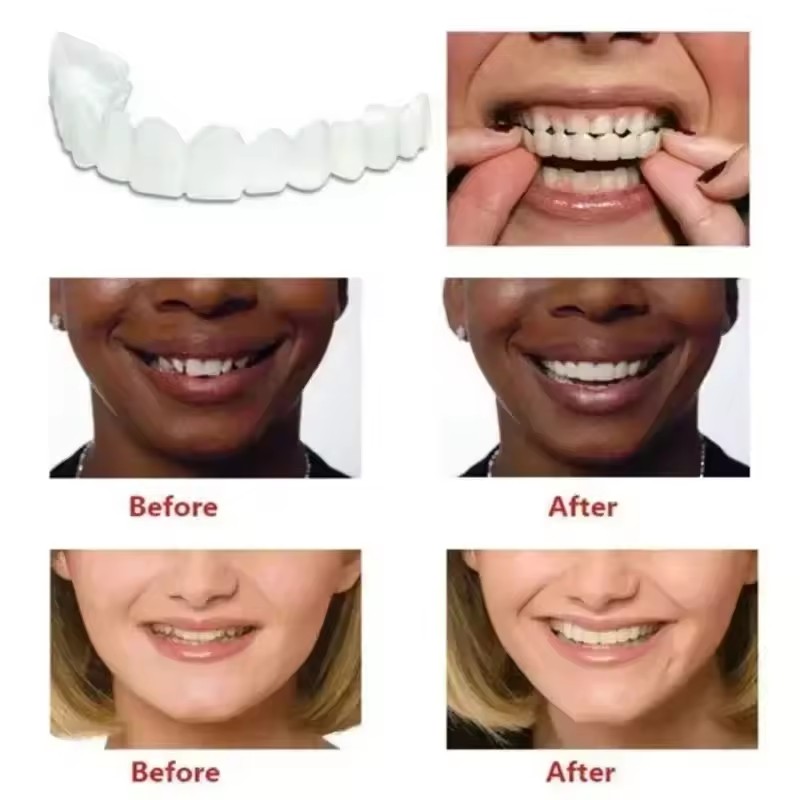 Diş Kaplamaları Beyazlatma Pro - Teeth Whitening Veneers incelemesi ve fiyatı