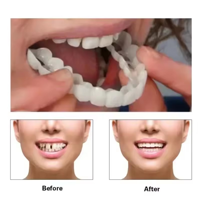 Diş Kaplamaları Beyazlatma Pro - Teeth Whitening Veneers incelemesi ve fiyatı