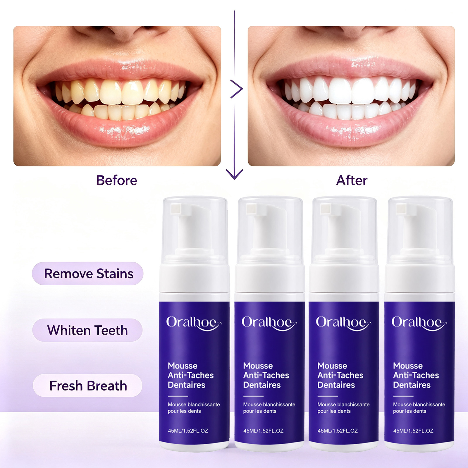 Mor Köpüren Diş Beyazlatıcı Di - Teeth Whitening Routine incelemesi ve fiyatı