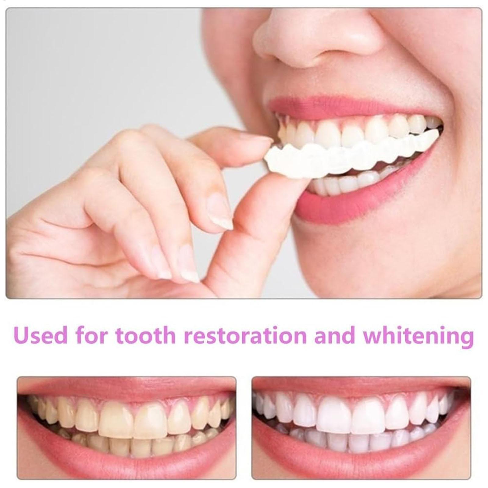 2 adet Erkek Kadın Geçici Diş  - Teeth Whitening Veneers incelemesi ve fiyatı