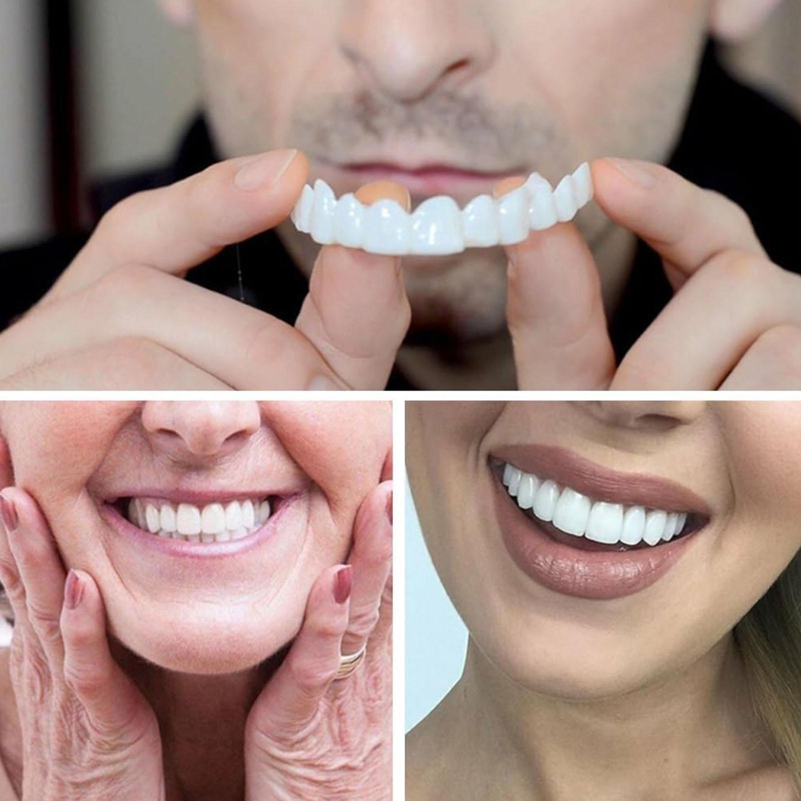 2 adet Erkek Kadın Geçici Diş  - Teeth Whitening Veneers incelemesi ve fiyatı
