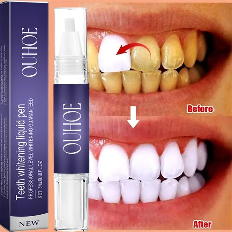 Hızlı Diş Beyazlatma Diş Macun - Whitening Pen Bleach incelemesi ve fiyatı
